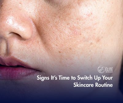 Signs It’s Time to Switch Up Your Skincare Routine