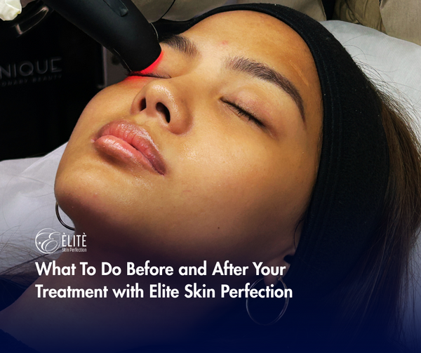 What To Do Before and After Your Treatment with Elite Skin Perfection